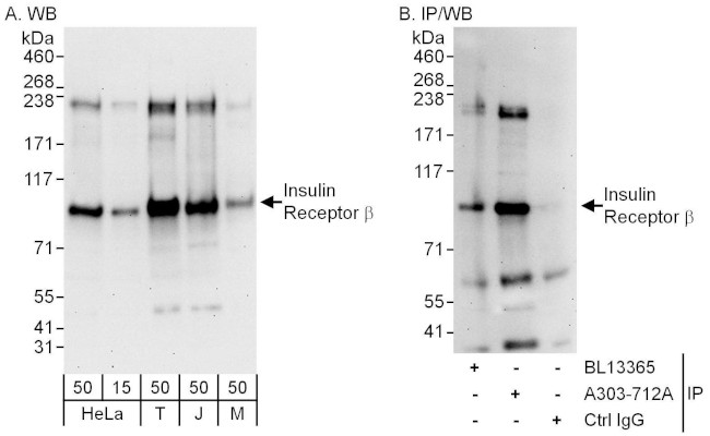 Insulin Receptor Beta Antibody in Western Blot (WB)