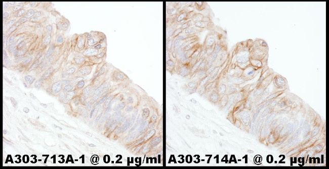 Alpha-Adducin Antibody in Immunohistochemistry (Paraffin) (IHC (P))