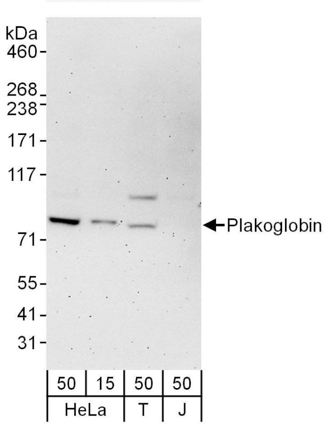 Plakoglobin Antibody in Western Blot (WB)