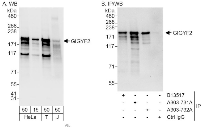 GIGYF2 Antibody in Western Blot (WB)