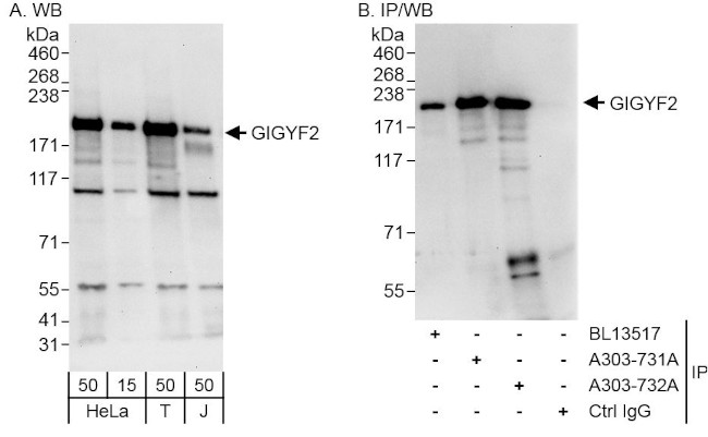 GIGYF2 Antibody in Western Blot (WB)