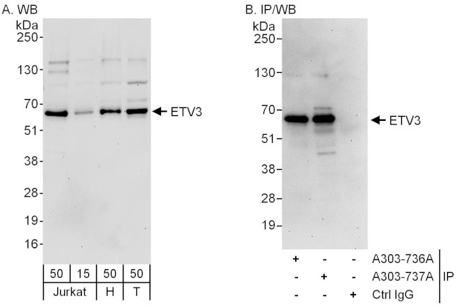 ETV3 Antibody in Western Blot (WB)