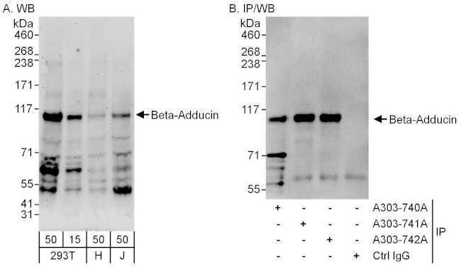 Beta-Adducin Antibody in Western Blot (WB)