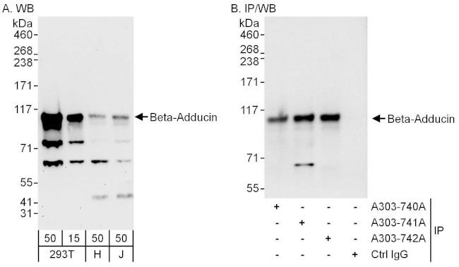 Beta-Adducin Antibody in Western Blot (WB)