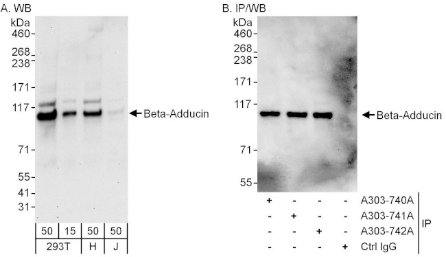 Beta-Adducin Antibody in Western Blot (WB)