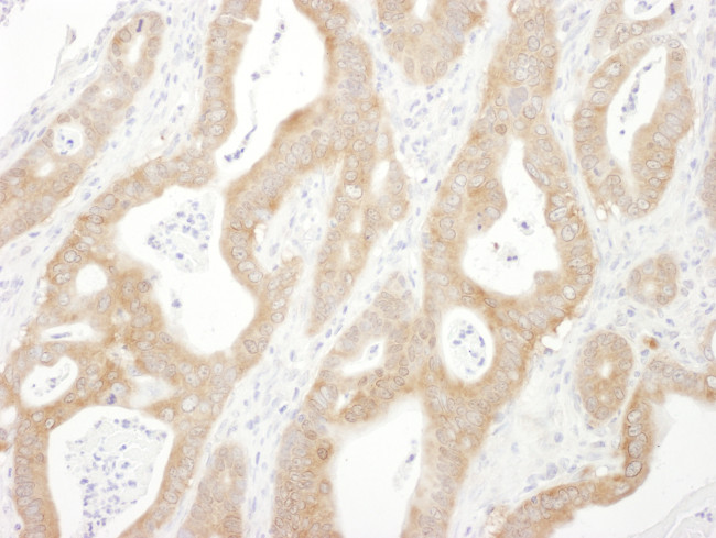 Beta-Arrestin 1 Antibody in Immunohistochemistry (Paraffin) (IHC (P))