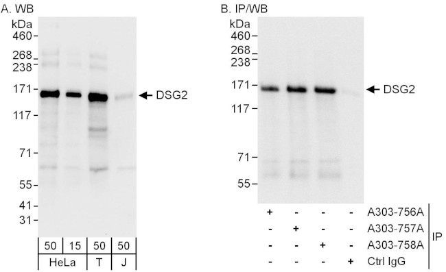 DSG2 Antibody in Western Blot (WB)