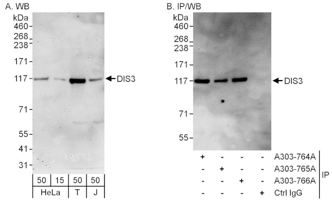 DIS3 Antibody in Western Blot (WB)