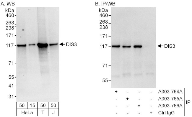 DIS3 Antibody in Western Blot (WB)