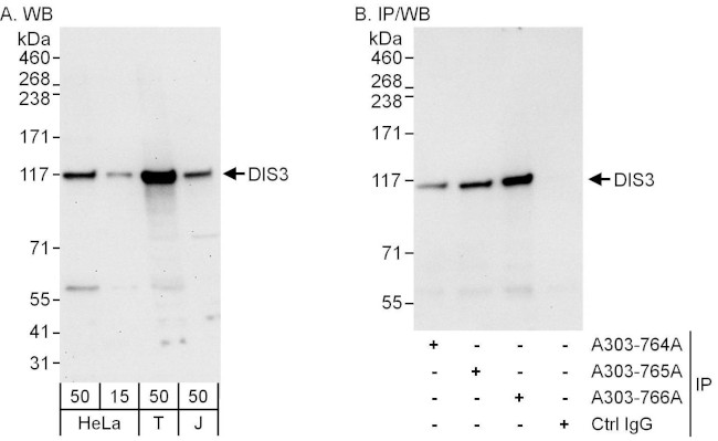 DIS3 Antibody in Western Blot (WB)