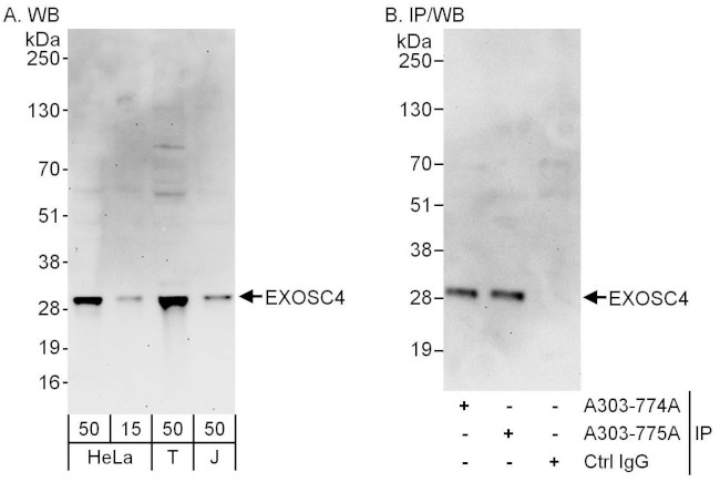 EXOSC4 Antibody in Western Blot (WB)