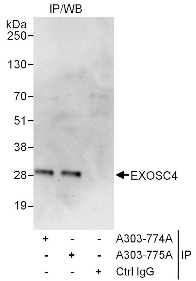 EXOSC4 Antibody in Immunoprecipitation (IP)