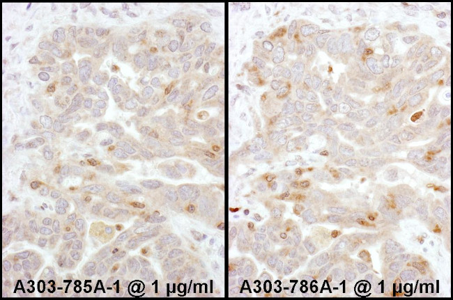 Beta-Arrestin 2 Antibody in Immunohistochemistry (Paraffin) (IHC (P))