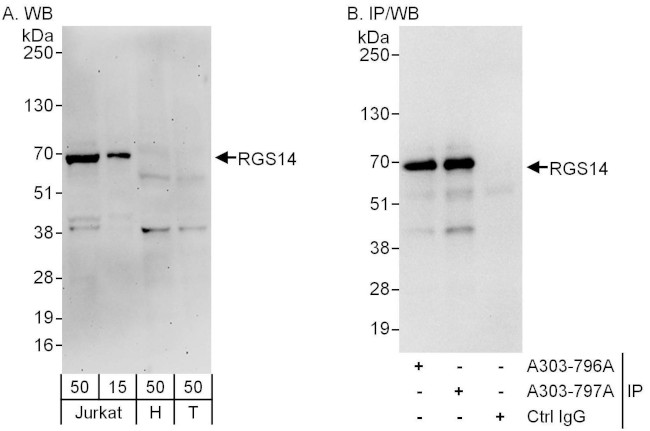 RGS14 Antibody in Western Blot (WB)