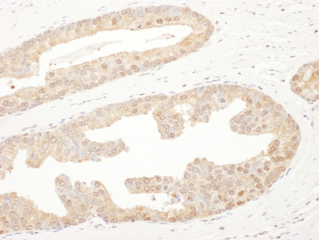 PSMA6 Antibody in Immunohistochemistry (Paraffin) (IHC (P))