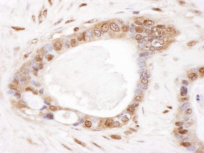 PSMB2 Antibody in Immunohistochemistry (Paraffin) (IHC (P))