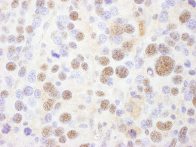 PSMC1 Antibody in Immunohistochemistry (Paraffin) (IHC (P))