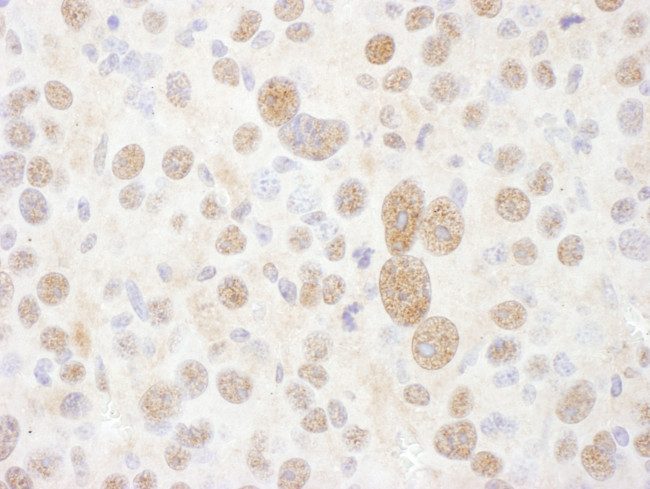 PSMC2 Antibody in Immunohistochemistry (Paraffin) (IHC (P))