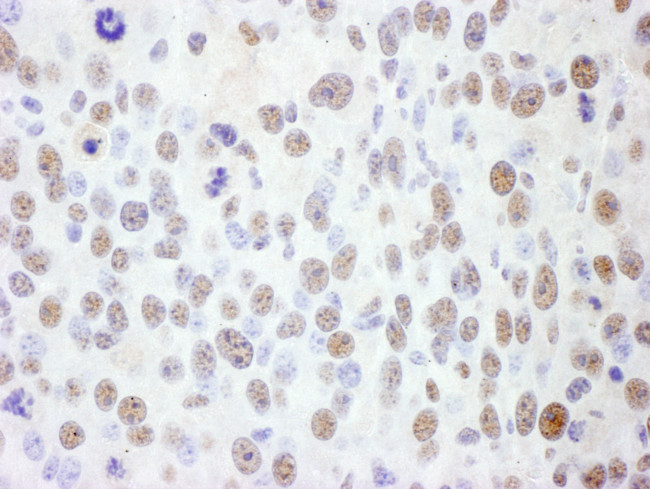 SMC1 Antibody in Immunohistochemistry (Paraffin) (IHC (P))