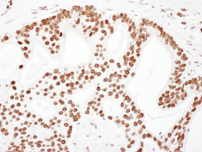 KAP-1 Antibody in Immunohistochemistry (Paraffin) (IHC (P))