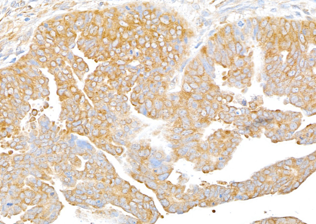 RPS3 Antibody in Immunohistochemistry (Paraffin) (IHC (P))