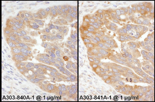 RPS3 Antibody in Immunohistochemistry (Paraffin) (IHC (P))