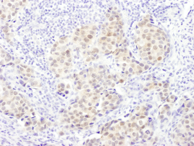 PSMB5 Antibody in Immunohistochemistry (Paraffin) (IHC (P))