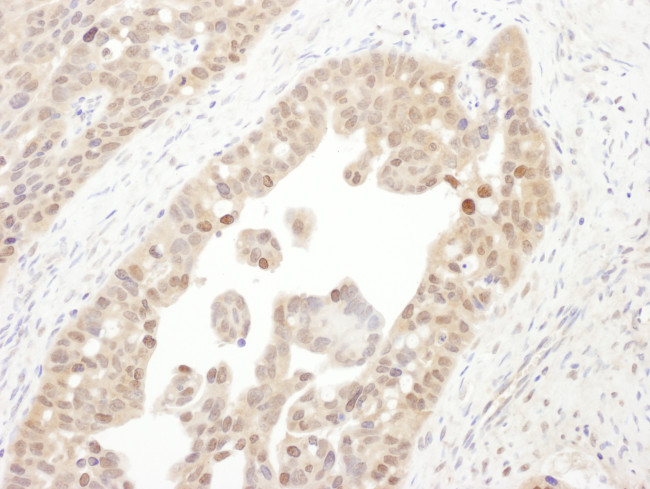 PSMC4 Antibody in Immunohistochemistry (Paraffin) (IHC (P))