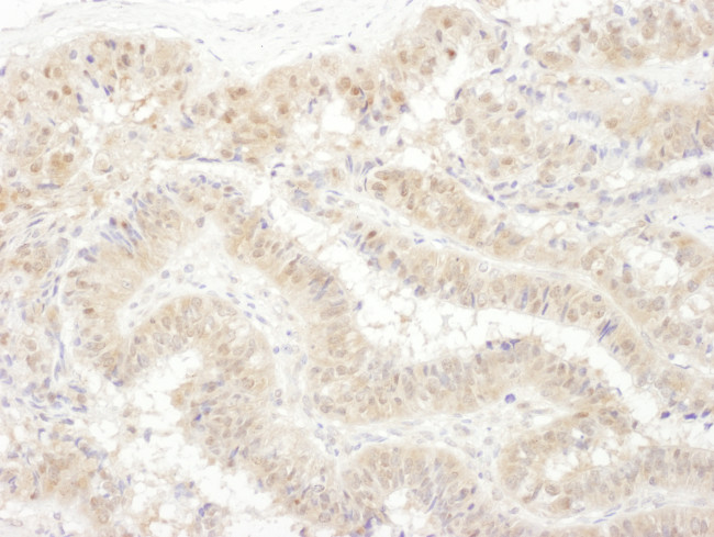 PSMC4 Antibody in Immunohistochemistry (Paraffin) (IHC (P))