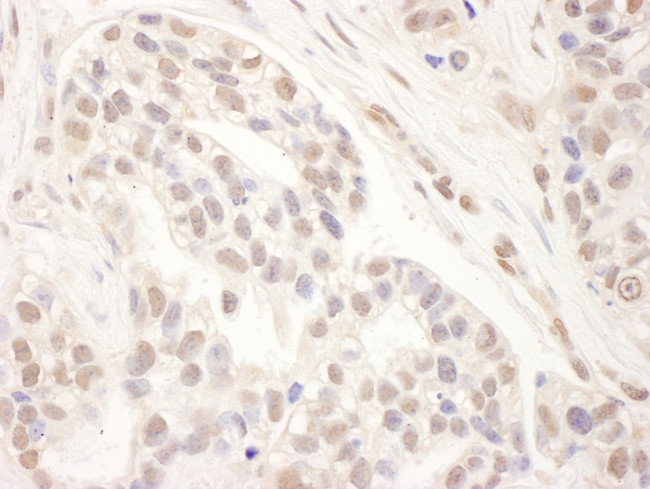 MED1 Antibody in Immunohistochemistry (Paraffin) (IHC (P))