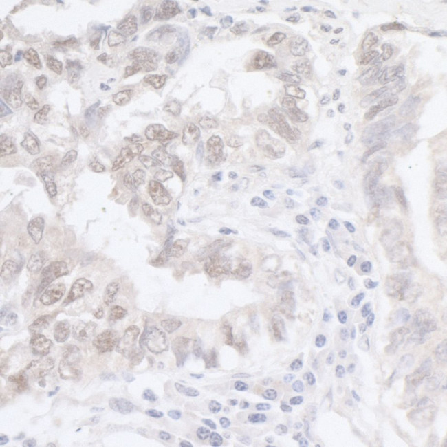 ADAR1 Antibody in Immunohistochemistry (Paraffin) (IHC (P))