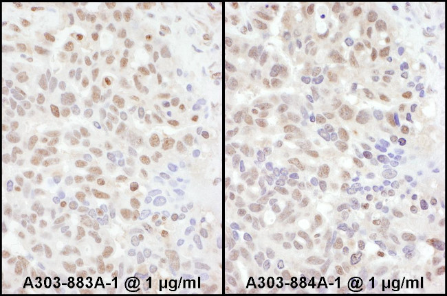 ADAR1 Antibody in Immunohistochemistry (Paraffin) (IHC (P))