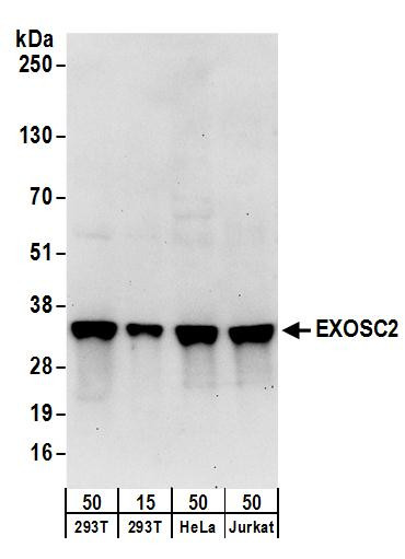 EXOSC2 Antibody in Western Blot (WB)