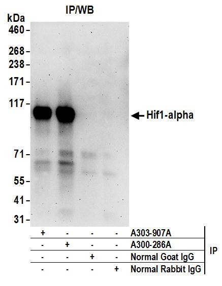 HIF1-alpha Antibody in Immunoprecipitation (IP)