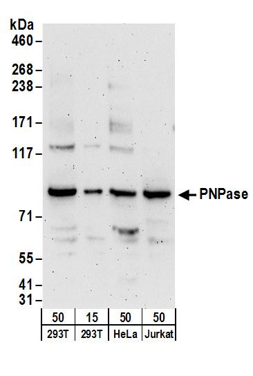 PNPase Antibody in Western Blot (WB)