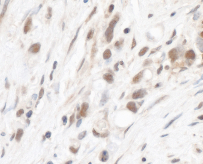 RPL5 Antibody in Immunohistochemistry (Paraffin) (IHC (P))