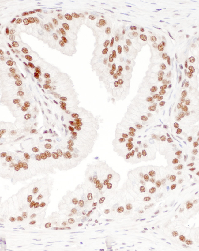 DBC1/p30 DBC Antibody in Immunohistochemistry (Paraffin) (IHC (P))