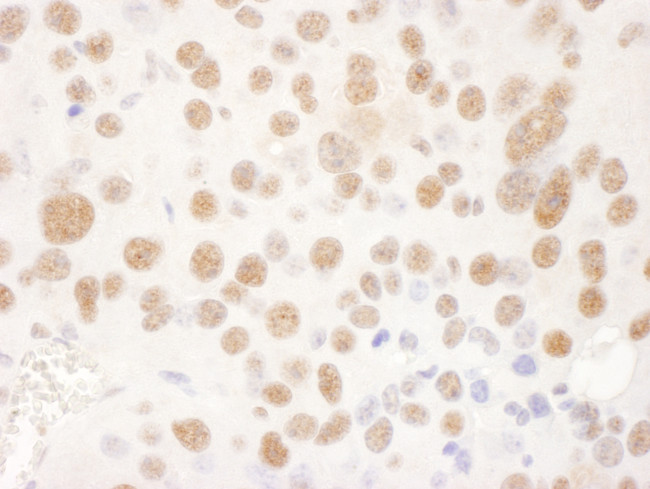 USP7 Antibody in Immunohistochemistry (Paraffin) (IHC (P))