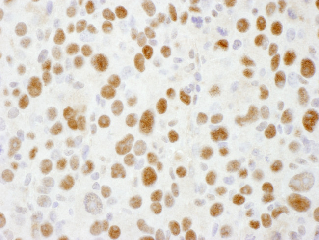 Sp1 Antibody in Immunohistochemistry (Paraffin) (IHC (P))