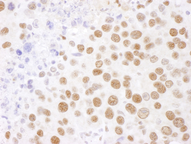 SF3B4 Antibody in Immunohistochemistry (Paraffin) (IHC (P))