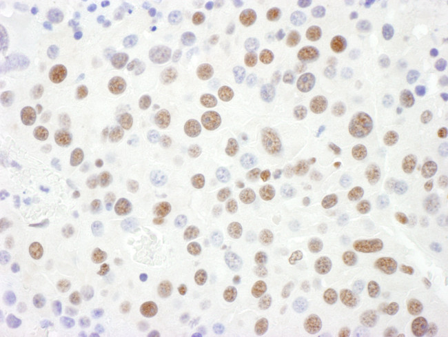 Sm-D3 Antibody in Immunohistochemistry (Paraffin) (IHC (P))