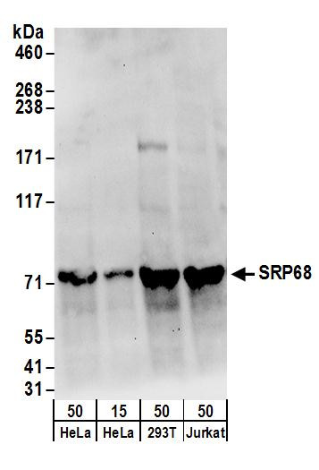 SRP68 Antibody in Western Blot (WB)