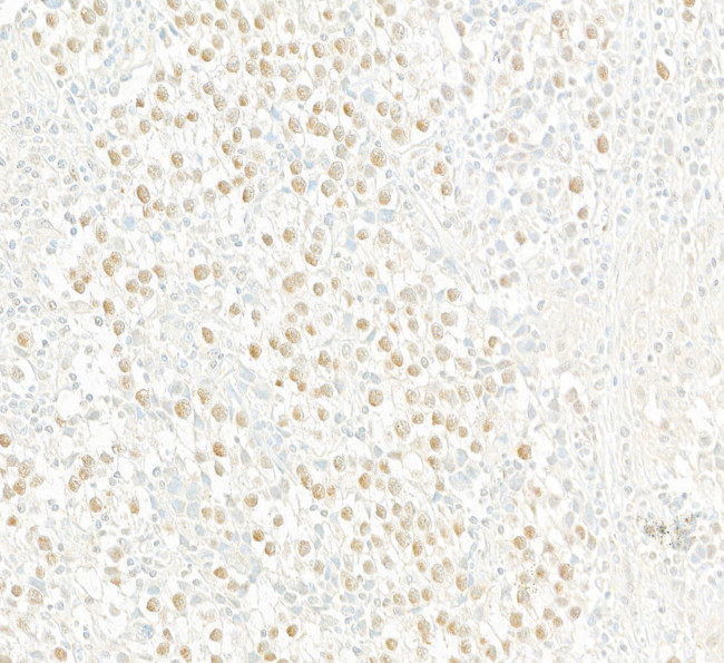 Androgen Receptor Antibody in Immunohistochemistry (Paraffin) (IHC (P))