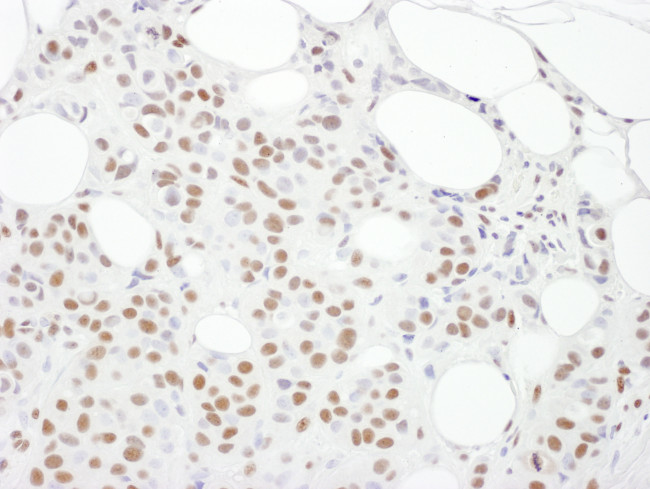 DNA-PKcs Antibody in Immunohistochemistry (Paraffin) (IHC (P))