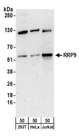 RRP9 Antibody in Western Blot (WB)