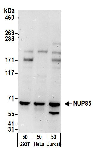 NUP85 Antibody in Western Blot (WB)