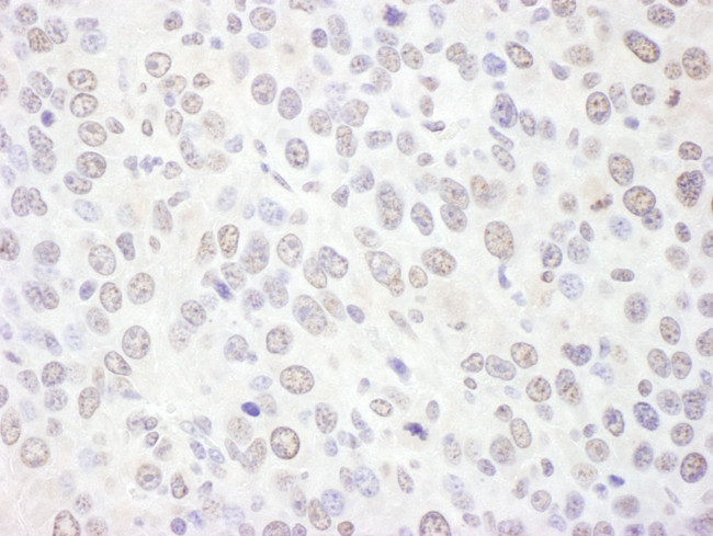 EXOSC10 Antibody in Immunohistochemistry (Paraffin) (IHC (P))