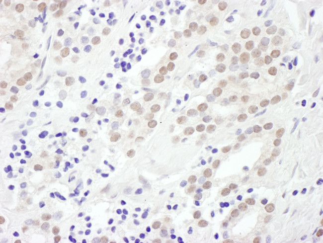 EXOSC10 Antibody in Immunohistochemistry (Paraffin) (IHC (P))