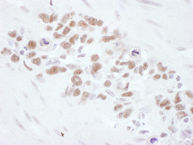 Mre11 Antibody in Immunohistochemistry (Paraffin) (IHC (P))