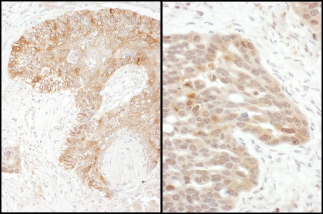 TS Antibody in Immunohistochemistry (Paraffin) (IHC (P))